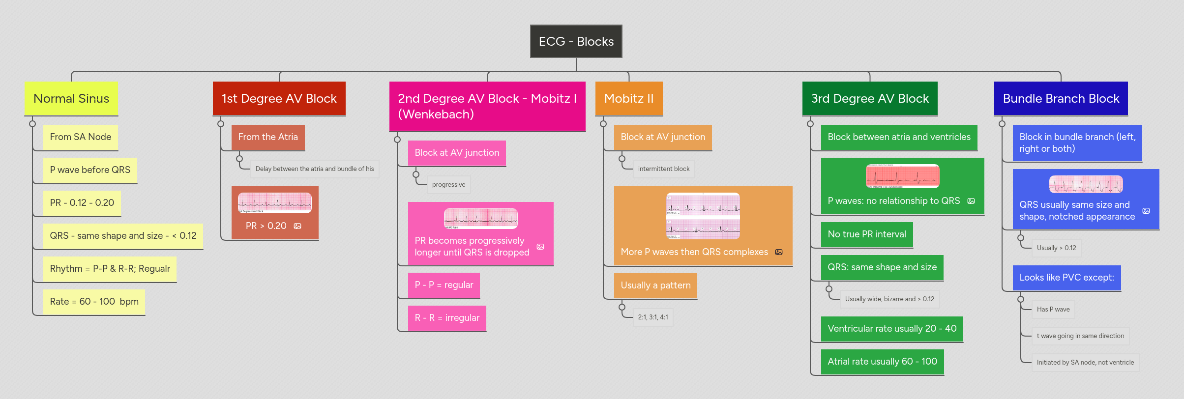 ECG - Blocks | MindMeister Mind map