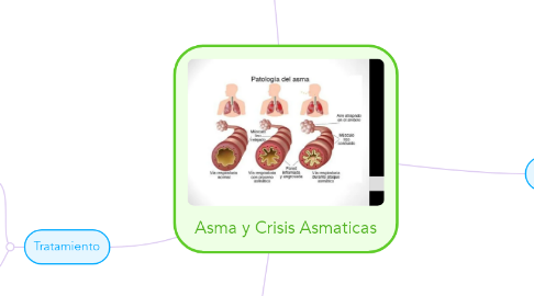Mind Map: Asma y Crisis Asmaticas