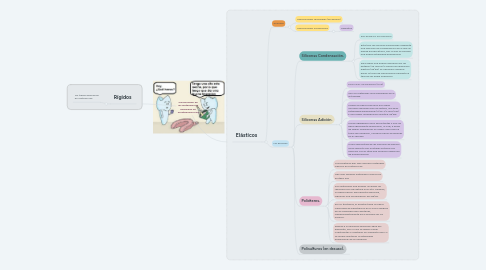 Mind Map: Clasificación de los materiales de impresión en Prostodoncia Fija