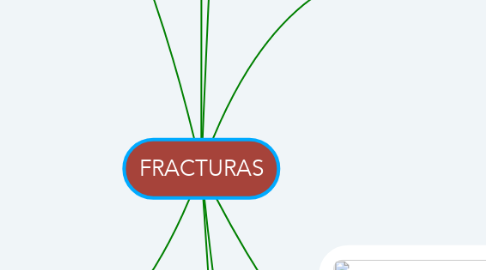 Mind Map: FRACTURAS