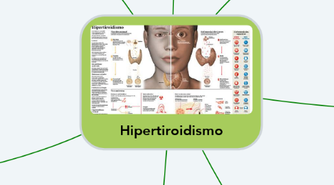Mind Map: Hipertiroidismo