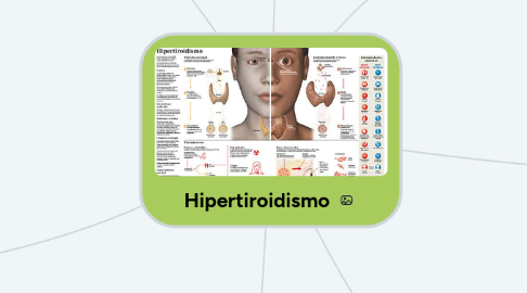 Mind Map: Hipertiroidismo