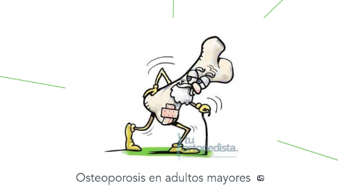 Mind Map: Osteoporosis en adultos mayores