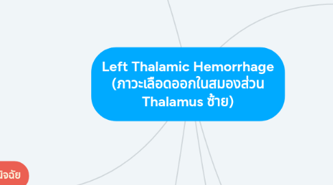 Mind Map: Left Thalamic Hemorrhage (ภาวะเลือดออกในสมองส่วน Thalamus ซ้าย)