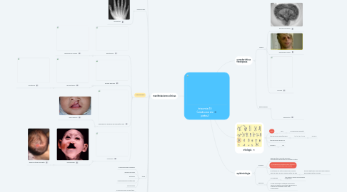 Mind Map: trisomia 13 (sindrome de patau)