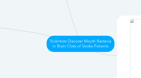 Mind Map: Scientists Discover Mouth Bacteria in Brain Clots of Stroke Patients