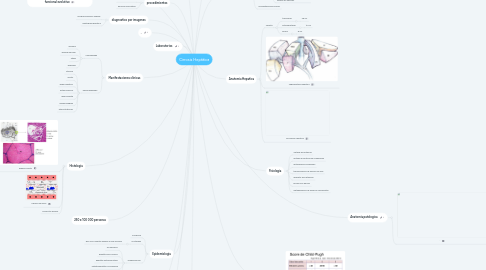 Mind Map: Cirrosis Hepática