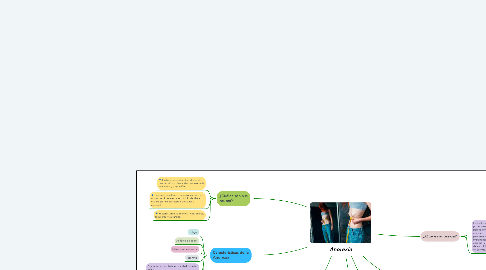 Mind Map: Anorexia