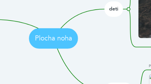 Mind Map: Plocha noha