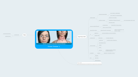 Mind Map: Graves' Disease