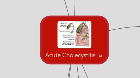 Mind Map: Acute Cholecystitis