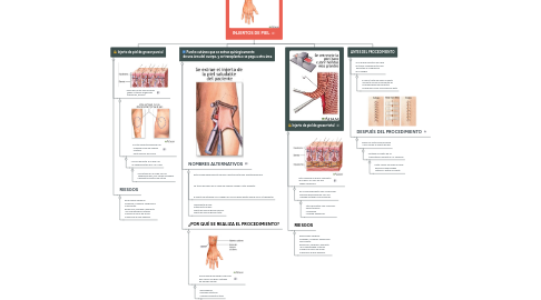 Mind Map: INJERTOS DE PIEL