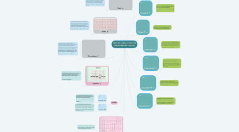 Mind Map: Tipos de onda y problemas funcionales del corazón