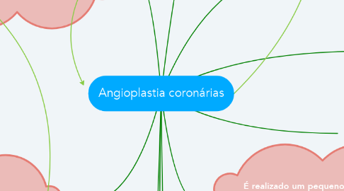 Mind Map: Angioplastia coronárias