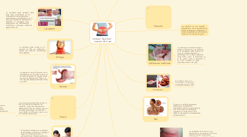 Mind Map: Síntomas Digestivos - Cuidados de la piel