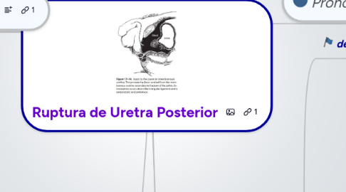 Mind Map: Ruptura de Uretra Posterior