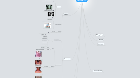 Mind Map: Lung Cancer