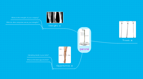 Mind Map: peroné