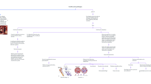 Mind Map: Calcificación patológica