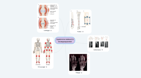 Mind Map: Sygdomme relateret til bevægeapparatet