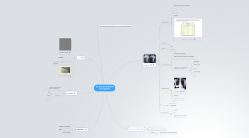 Mind Map: Vad påverkar bildkvalite i en röntgenbild