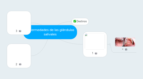 Mind Map: Enfermedades de las glándulas salivales