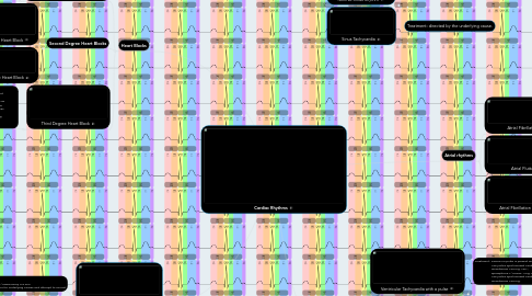 Mind Map: Cardiac Rhythms