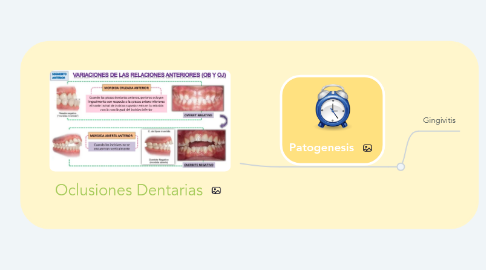 Mind Map: Oclusiones Dentarias