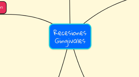 Mind Map: Recesiones Gingivales