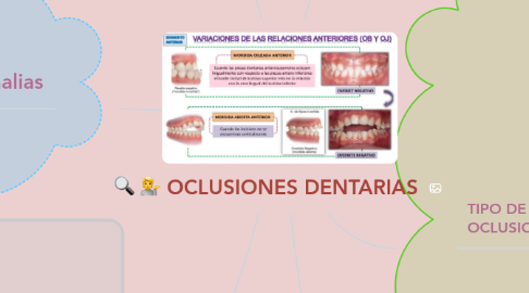 Mind Map: OCLUSIONES DENTARIAS